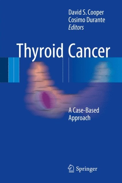 Cosimo Durante, David S. Cooper - Thyroid Cancer, E-bok