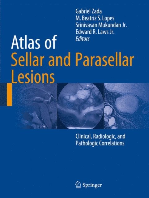 Edward R. Laws Jr., Srinivasan Mukundan Jr., M. Beatriz S. Lopes, Gabriel Zada - Atlas of Sellar and Parasellar Lesions, E-bok