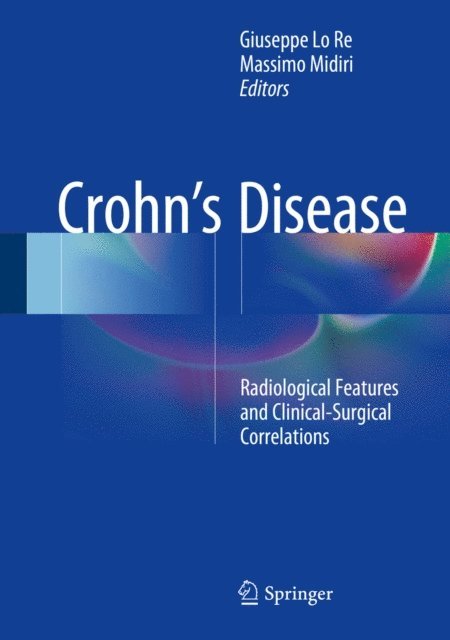 Massimo Midiri, Giuseppe Lo Re - Crohn's Disease, E-bok