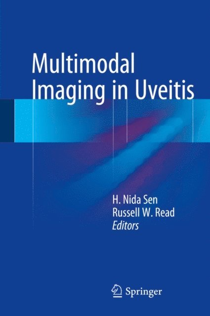 Russell W. Read, H. Nida Sen - Multimodal Imaging in Uveitis, E-bok