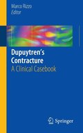 Dupuytrens Contracture