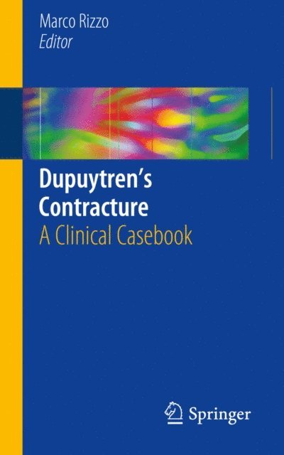 Marco Rizzo - Dupuytren's Contracture, E-bok