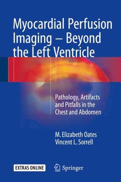 Vincent L. Sorrell, M. Elizabeth Oates - Myocardial Perfusion Imaging - Beyond the Left Ventricle, E-bok