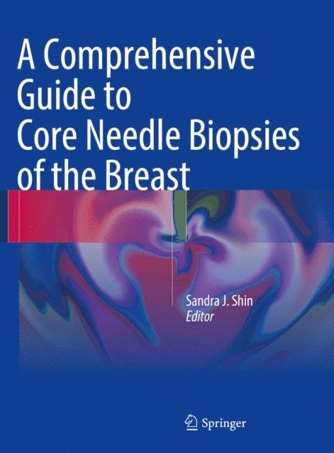 Sandra J. Shin - Comprehensive Guide to Core Needle Biopsies of the Breast, E-bok