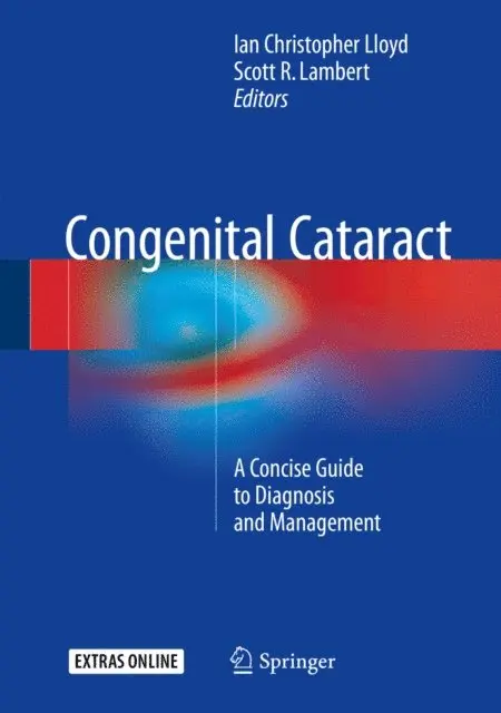 Scott R. Lambert, Ian Christopher Lloyd - Congenital Cataract, E-bok. Tillgänglighet: Lägg i varukorg