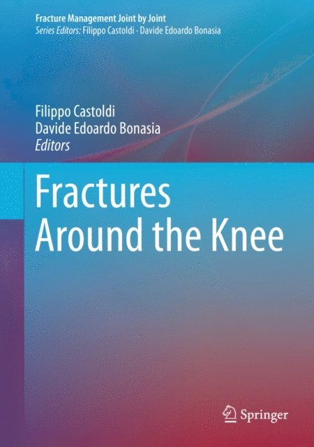 Davide Edoardo Bonasia, Filippo Castoldi - Fractures Around the Knee, E-bok. Tillgänglighet: Lägg i varukorg
