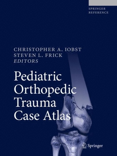 Steven L. Frick, Christopher A. Iobst - Pediatric Orthopedic Trauma Case Atlas, E-bok