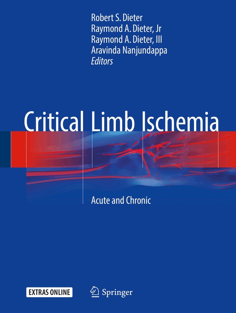 Robert S. Dieter, Raymond A. Dieter, Jr, Raymond A. Dieter, III, Aravinda Nanjundappa - Critical Limb Ischemia, Inbunden