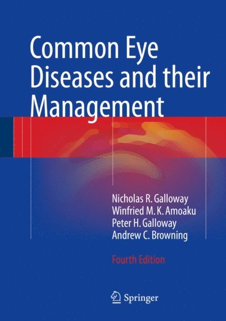 Andrew C Browning, Peter H. Galloway, Winfried M. K. Amoaku, Nicholas R. Galloway - Common Eye Diseases and their Management, E-bok