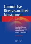 Common Eye Diseases and their Management