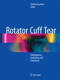 Rotator Cuff Tear