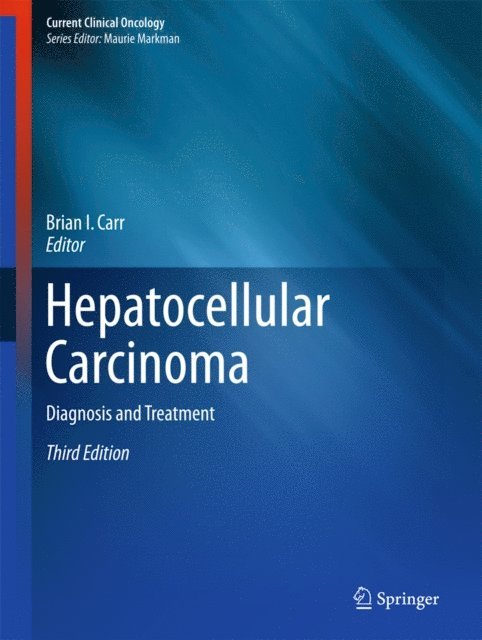 Brian I. Carr - Hepatocellular Carcinoma, E-bok
