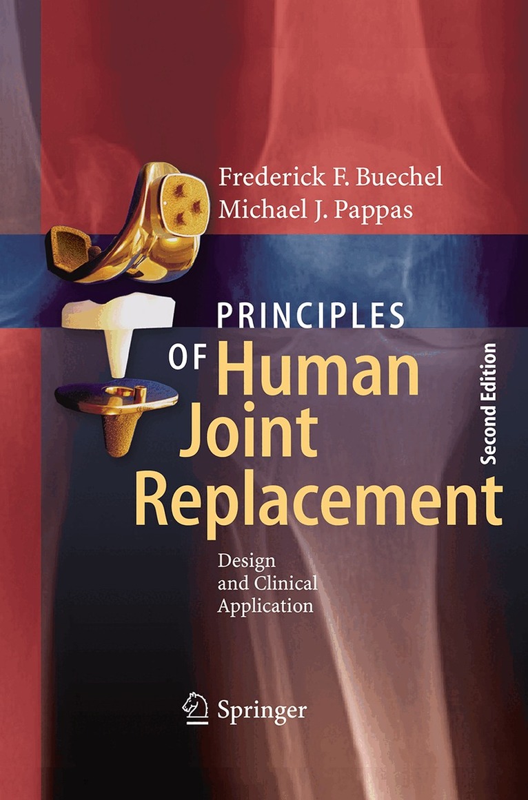 Frederick F. Buechel, Michael J. Pappas - Principles of Human Joint Replacement, Häftad