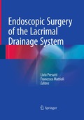 Endoscopic Surgery of the Lacrimal Drainage System