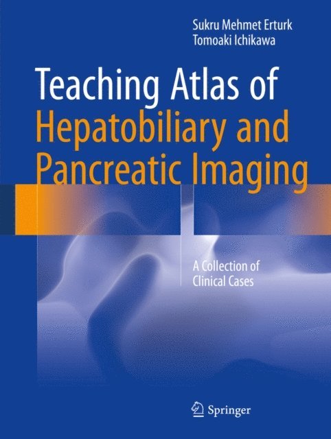 Tomoaki Ichikawa, Sukru Mehmet Erturk - Teaching Atlas of Hepatobiliary and Pancreatic Imaging, E-bok