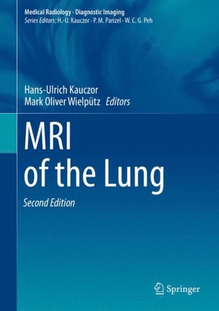 Mark Oliver Wielputz, Hans-Ulrich Kauczor - MRI of the Lung, E-bok
