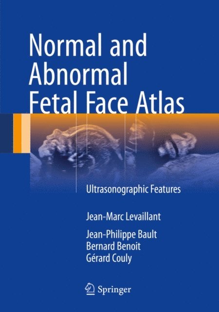 Gerard Couly, Bernard Benoit, Jean-Philippe Bault, Jean-Marc Levaillant - Normal and Abnormal Fetal Face Atlas, E-bok