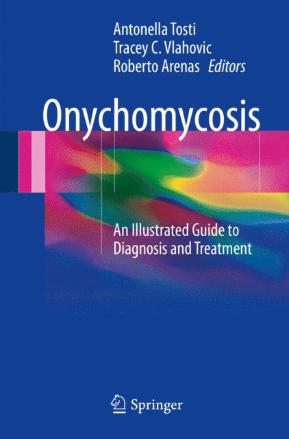 Roberto Arenas, Tracey C. Vlahovic, Antonella Tosti - Onychomycosis, E-bok. Tillgänglighet: Lägg i varukorg