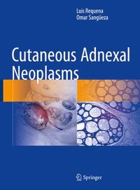 Cutaneous Adnexal Neoplasms