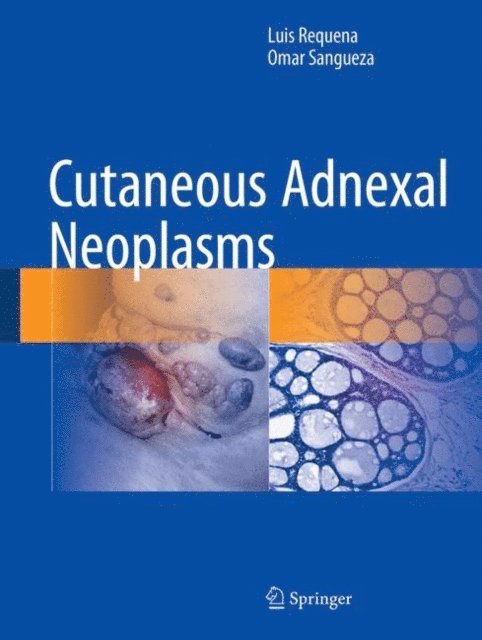 Omar Sangueza, Luis Requena - Cutaneous Adnexal Neoplasms, E-bok