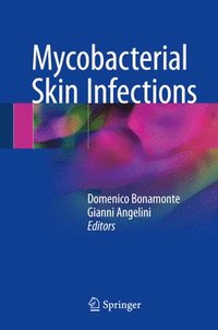 Tuberculosis And Nontuberculous Mycobacterial Infections - 