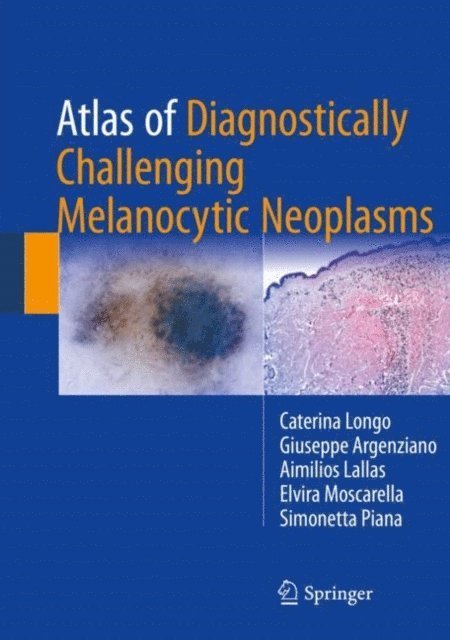 Simonetta Piana, Elvira Moscarella, Aimilios Lallas, Giuseppe Argenziano, Caterina Longo - Atlas of Diagnostically Challenging Melanocytic Neoplasms, E-bok