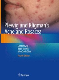 Plewig and Kligmans Acne and Rosacea