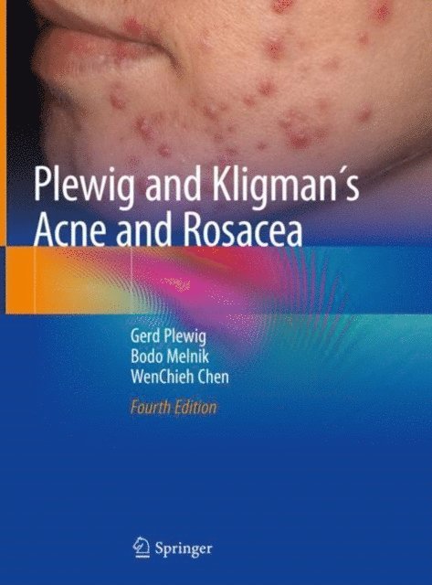 WenChieh Chen, Bodo Melnik, Gerd Plewig - Plewig and Kligman's Acne and Rosacea, E-bok