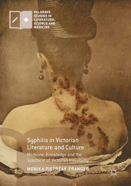 Monika Pietrzak-Franger - Syphilis in Victorian Literature and Culture, E-bok