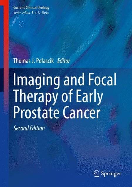Thomas J. Polascik - Imaging and Focal Therapy of Early Prostate Cancer, E-bok