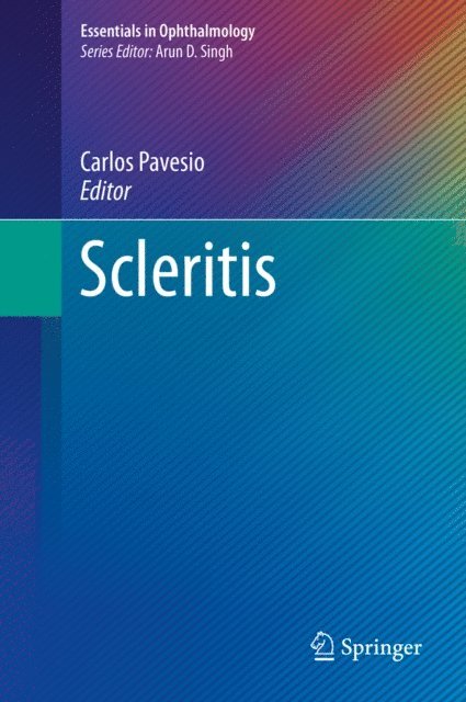 Carlos Pavesio - Scleritis, E-bok