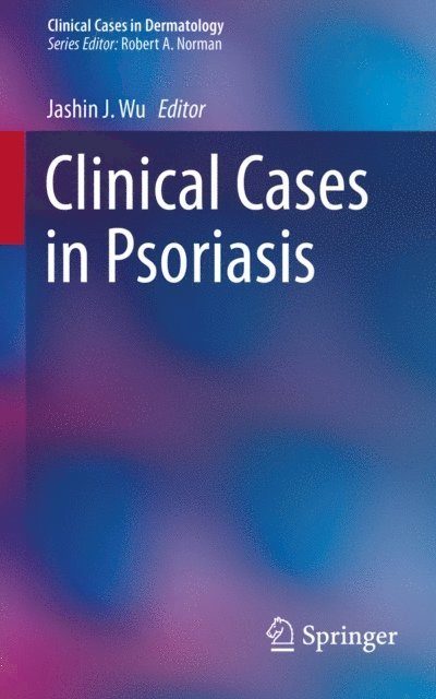 Jashin J. Wu - Clinical Cases in Psoriasis, E-bok