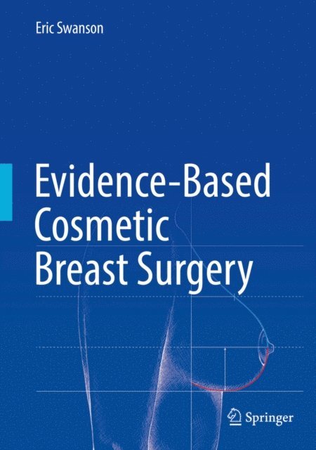Eric Swanson - Evidence-Based Cosmetic Breast Surgery, E-bok