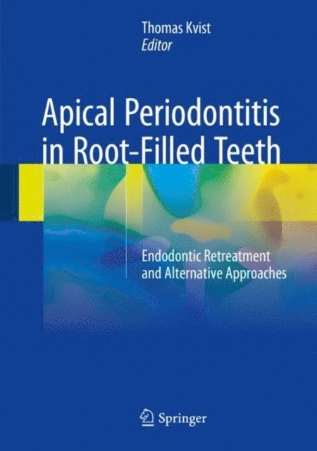 Thomas Kvist - Apical Periodontitis in Root-Filled Teeth, E-bok