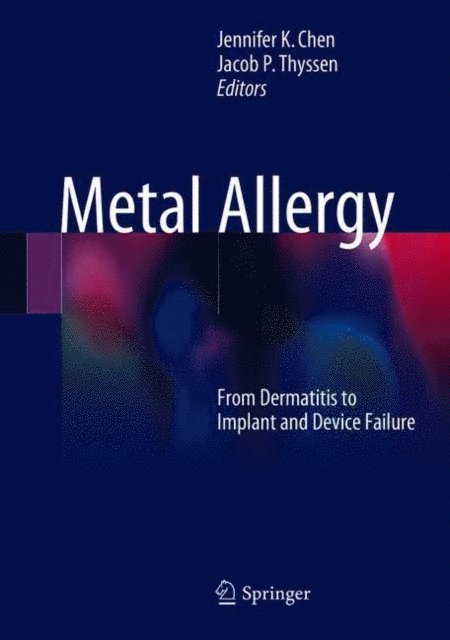 Jacob P. Thyssen, Jennifer K Chen - Metal Allergy, E-bok