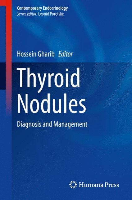 Hossein Gharib - Thyroid Nodules, E-bok