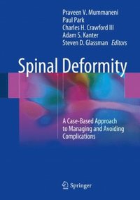 Spinal Deformity 