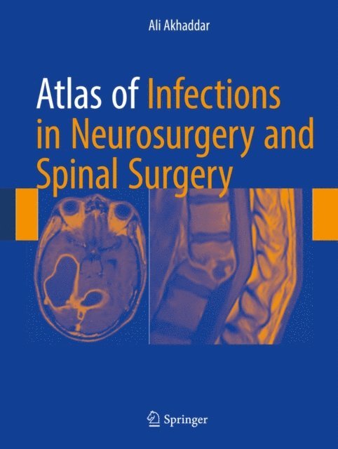 Ali Akhaddar - Atlas of Infections in Neurosurgery and Spinal Surgery, E-bok