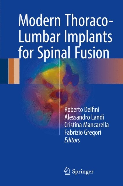 Fabrizio Gregori, Cristina Mancarella, Alessandro Landi, Roberto Delfini - Modern Thoraco-Lumbar Implants for Spinal Fusion, E-bok