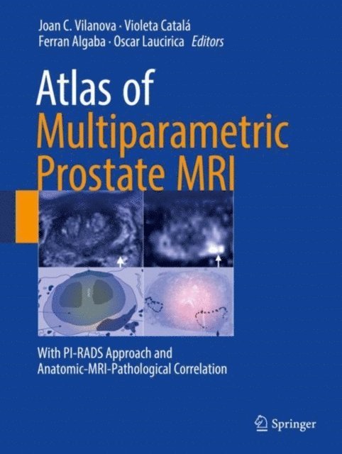Oscar Laucirica, Ferran Algaba, Violeta Catala, Joan C. Vilanova - Atlas of Multiparametric Prostate MRI, E-bok