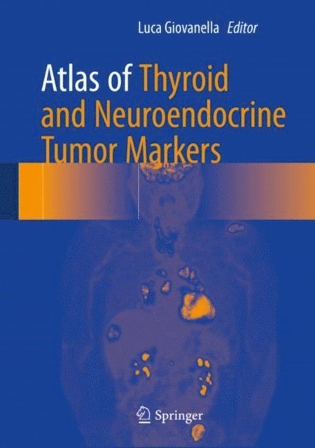 Luca Giovanella - Atlas of Thyroid and Neuroendocrine Tumor Markers, E-bok. Tillgänglighet: Lägg i varukorg