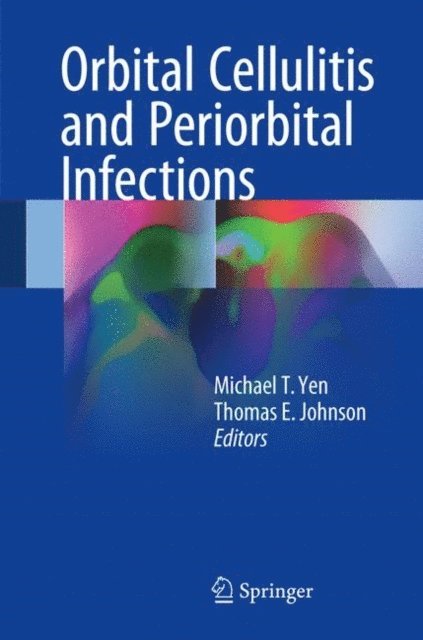 Thomas E. Johnson, Michael T. Yen - Orbital Cellulitis and Periorbital Infections, E-bok