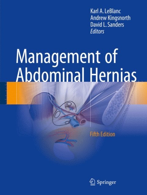 David L. Sanders, Andrew Kingsnorth, Karl A. LeBlanc - Management of Abdominal Hernias, E-bok