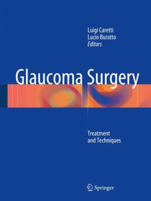 Lucio Buratto, Luigi Caretti - Glaucoma Surgery, E-bok. Tillgänglighet: Lägg i varukorg