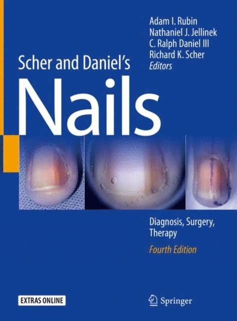 Richard K. Scher, C. Ralph Daniel III, Nathaniel J. Jellinek, Adam I. Rubin - Scher and Daniel's Nails, E-bok