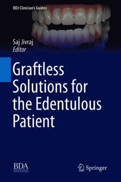 Saj Jivraj - Graftless Solutions for the Edentulous Patient, E-bok