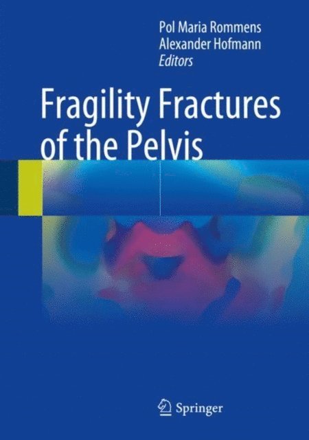 Alexander Hofmann, Pol Maria Rommens - Fragility Fractures of the Pelvis, E-bok