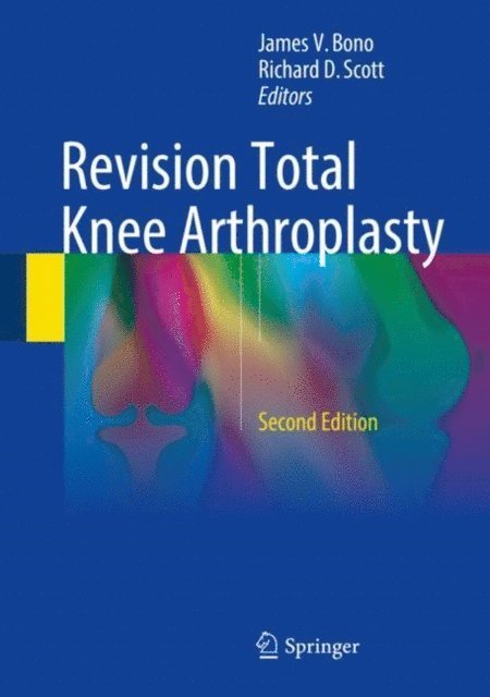 Richard D. Scott, James V. Bono - Revision Total Knee Arthroplasty, E-bok. Tillgänglighet: Lägg i varukorg