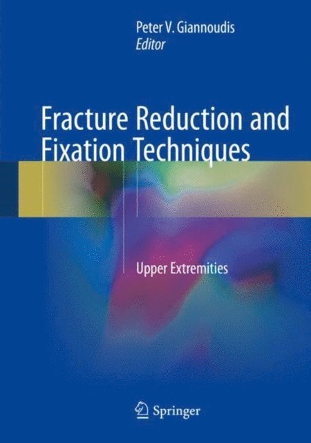 Peter V. Giannoudis - Fracture Reduction and Fixation Techniques, E-bok