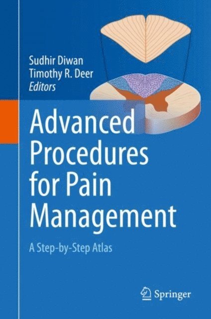 Timothy R Deer, Sudhir Diwan - Advanced Procedures for Pain Management, E-bok